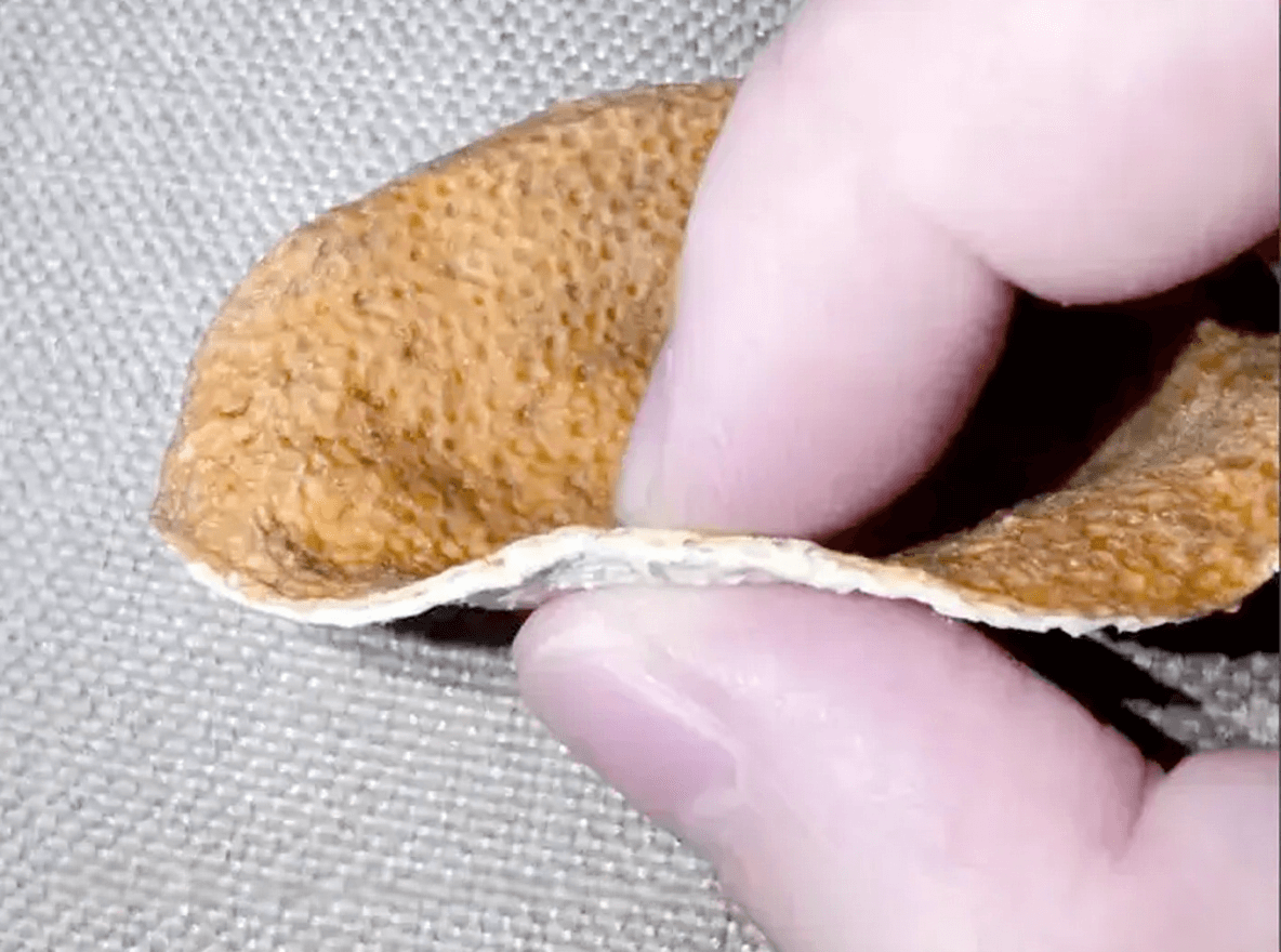 手术后能吃陈皮吗